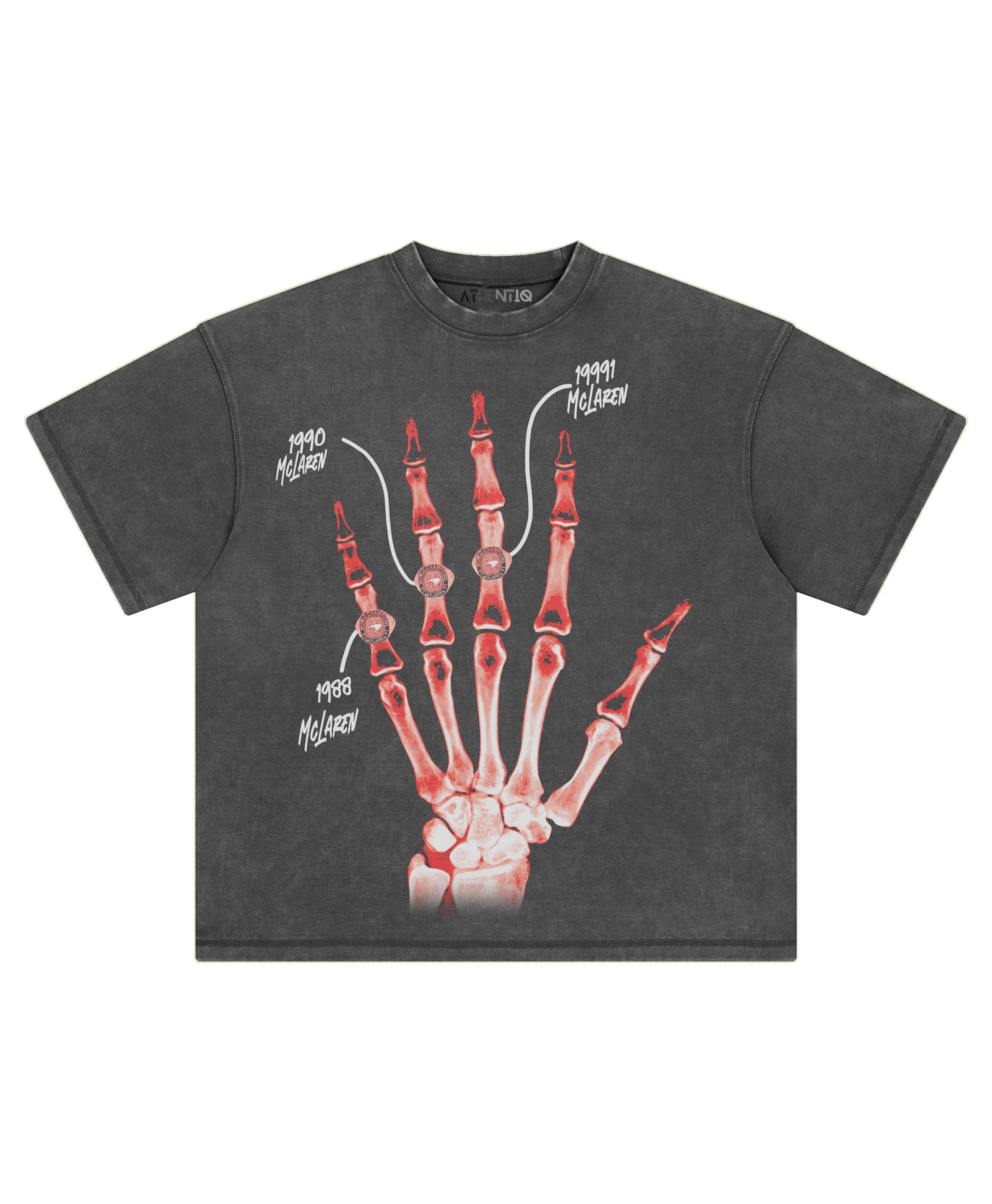 SENNA XRAY TEE