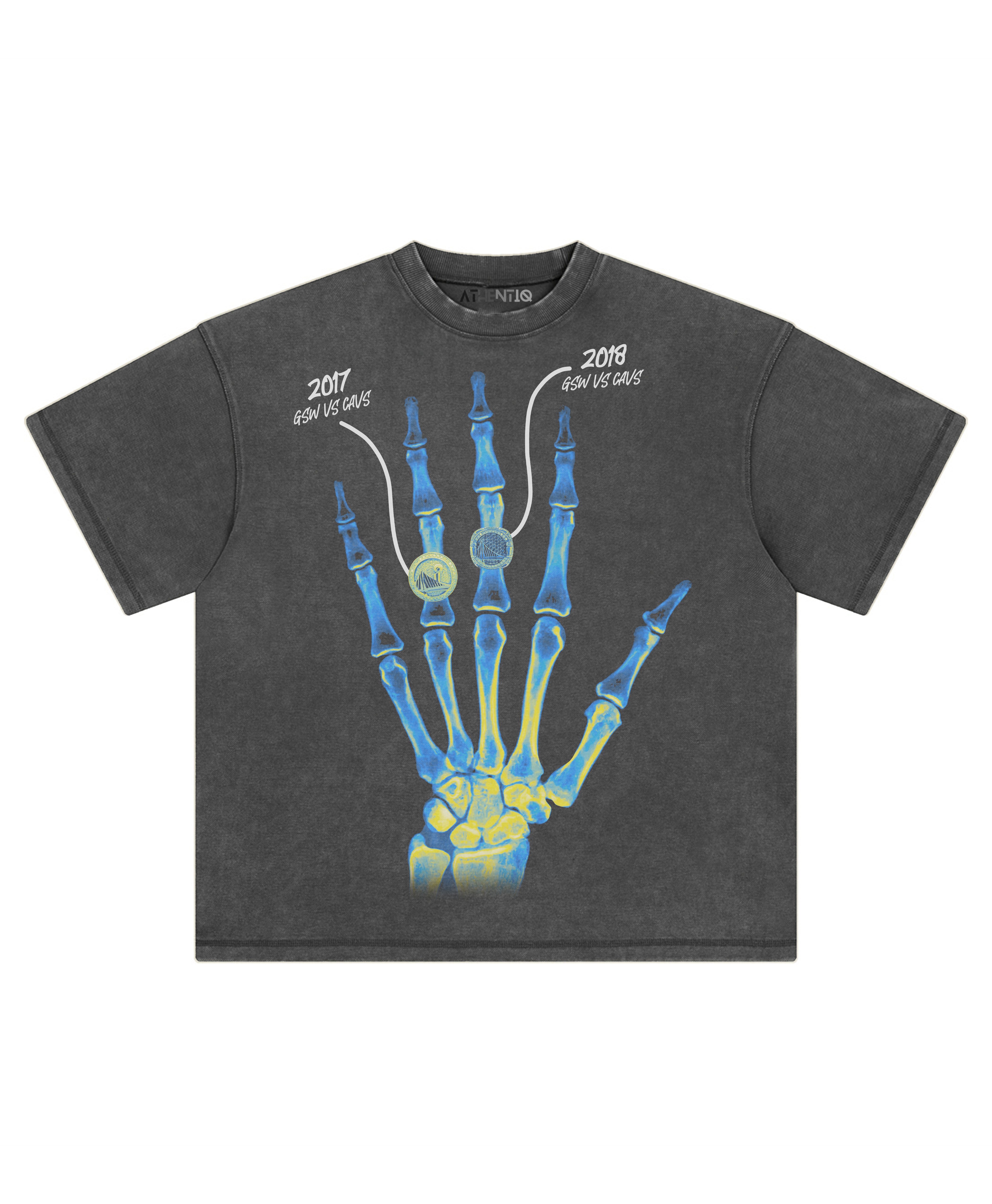 KD XRAY TEE